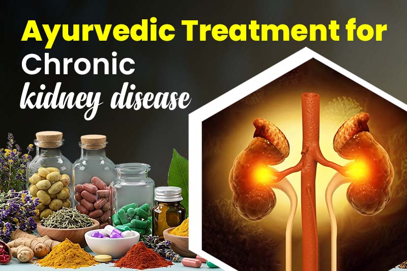 Best Ayurvedic Treatment for Chronic Kidney Disease