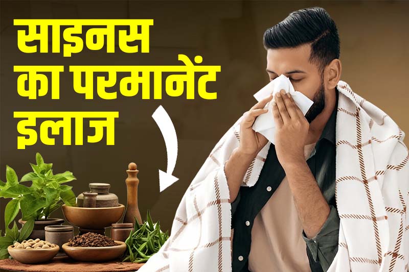 साइनस का परमानेंट इलाज