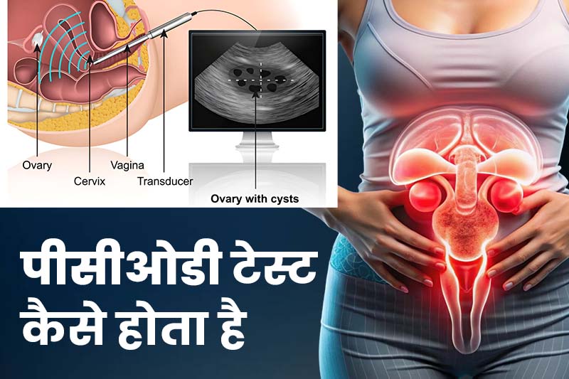 pcos test kaise hota hai