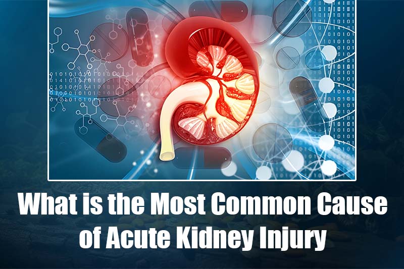 What is the Most Common Cause of Acute Kidney Injury