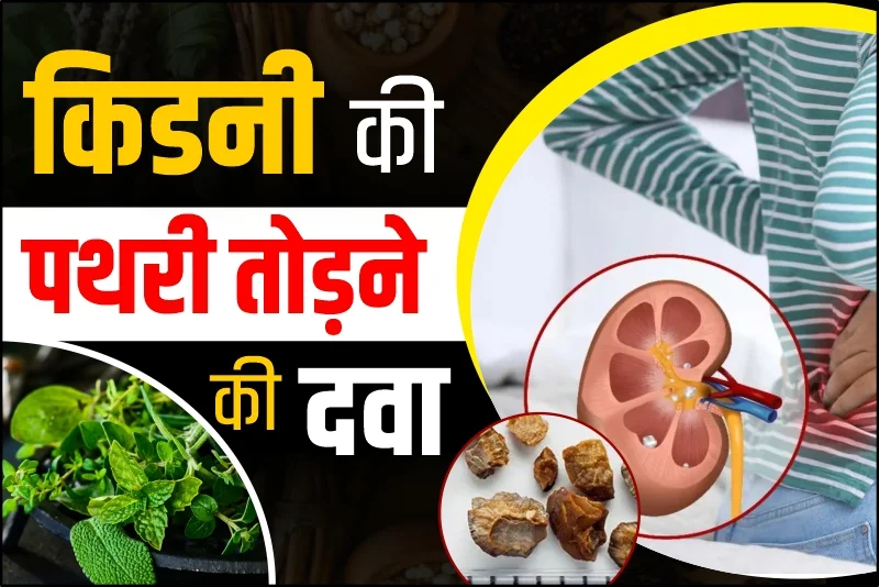 किडनी की पथरी तोड़ने की दवा