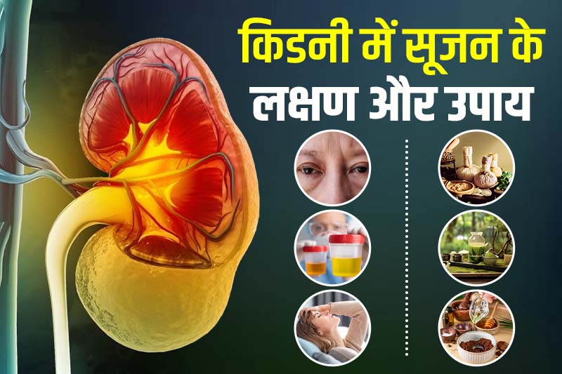 किडनी में सूजन के लक्षण और उपाय