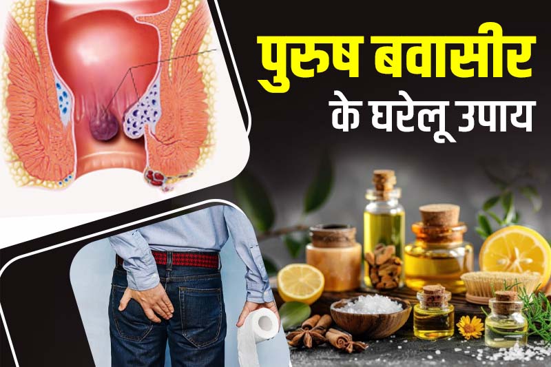पुरुष बवासीर के घरेलू उपाय