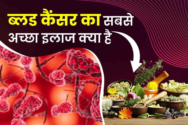 ब्लड कैंसर का सबसे अच्छा इलाज क्या है