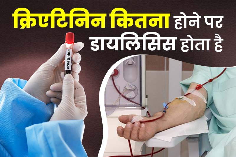 क्रिएटिनिन कितना होने पर डायलिसिस होता है
