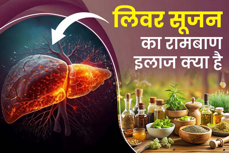 लिवर सूजन का रामबाण इलाज क्या है 
