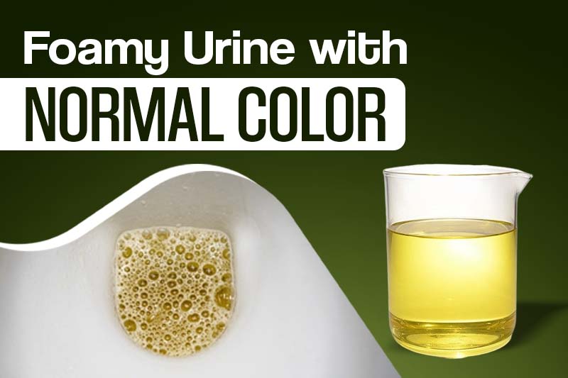 foamy urine with normal color